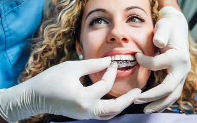 How Long Does It Take For Invisalign To Straighten Teeth?